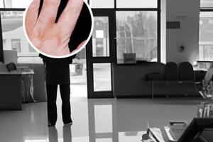 皮膚鏡干不干凈