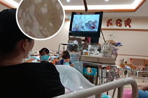 復(fù)方白斑膏白斑能擦嗎