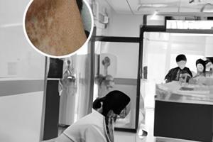 皮膚色素減退斑可以治愈嗎女性