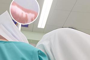 小孩臉上有白斑塊擦什么藥好的快