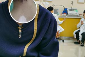 用了他克莫司軟膏癢得厲害