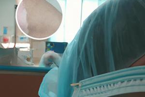 308照光是促進(jìn)皮膚表面黑色素分泌的嗎為什么