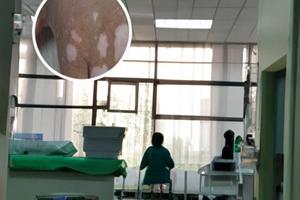 鄭州白斑十佳醫院名單圖片