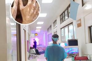 卡泊三醇軟膏效果好么