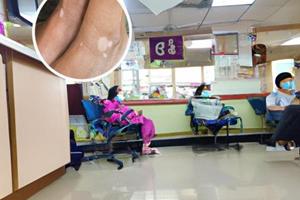 達力士不能涂臉嗎